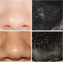 5pcs Remove Mineral Mud Nose Blackhead Pore Cleansing Cleaner Removal Nose Membranes Strips Anne GS