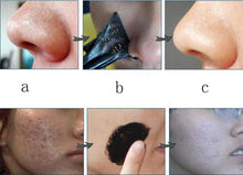 5pcs Remove Mineral Mud Nose Blackhead Pore Cleansing Cleaner Removal Nose Membranes Strips Anne GS